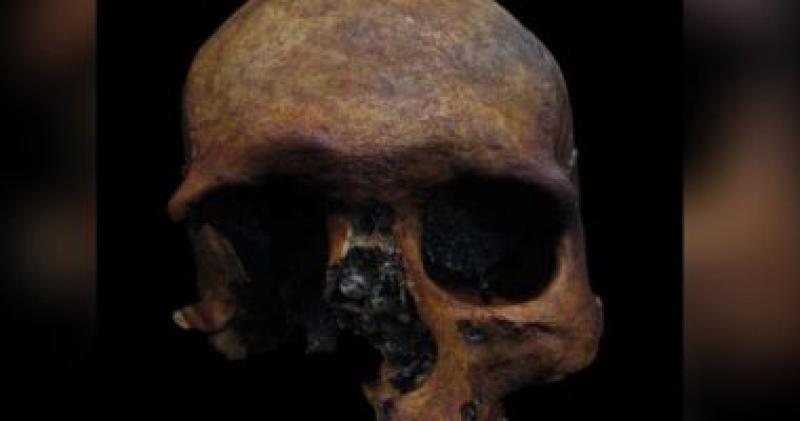 جمجمة تعود لـ400 سنة قبل الميلاد فى إسبانيا تكشف عن وجود ورم فى المخ